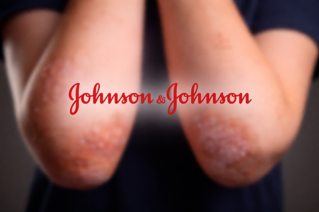 SKN | Could J&J’s New Psoriasis Pill Disrupt the $100 Billion Biologics Market?