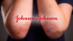 SKN | Could J&J’s New Psoriasis Pill Disrupt the $100 Billion Biologics Market?