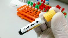 SKN | UCB to Acquire Candid Therapeutics in $2.2 Billion Deal to Expand Autoimmune Pipeline